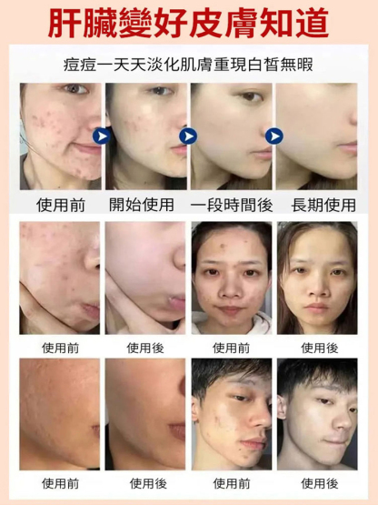 水飛薊人參佛手護肝貼