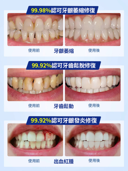牙醫推薦，早晚兩次，修復+防禦，持久有效