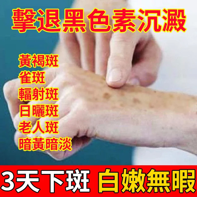 【3天變白,七天祛斑】草本美白祛斑霜