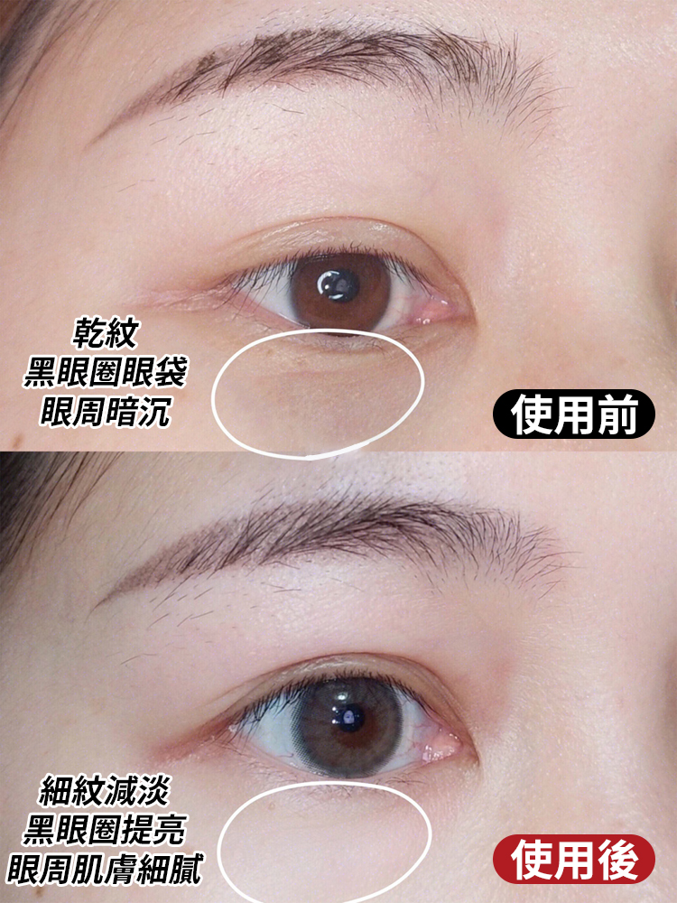 最新熱銷單品，一抹抗皺，眼部肌膚年輕10歲