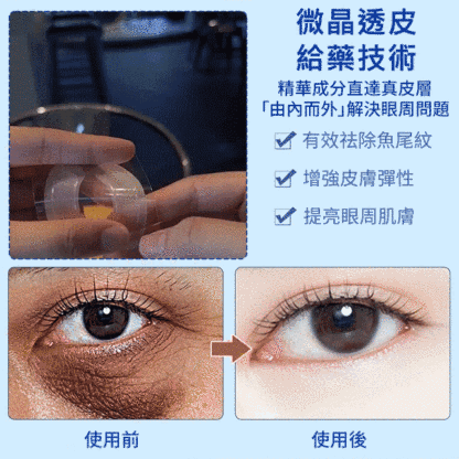 【3秒除皺】透明質酸微針眼貼