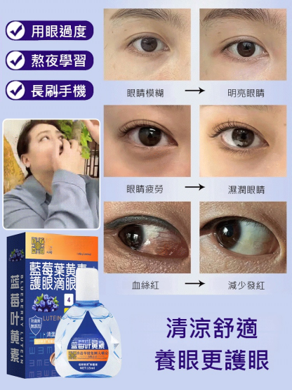 【滴眼疲勞】藍莓葉黃素緩解眼部疲勞眼藥水
