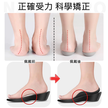 足外翻矯正隱形鞋墊