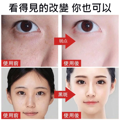 【黑斑消消消】清爽美白淡斑霜