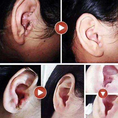 【專注耳健康】耳耵聹清洗器