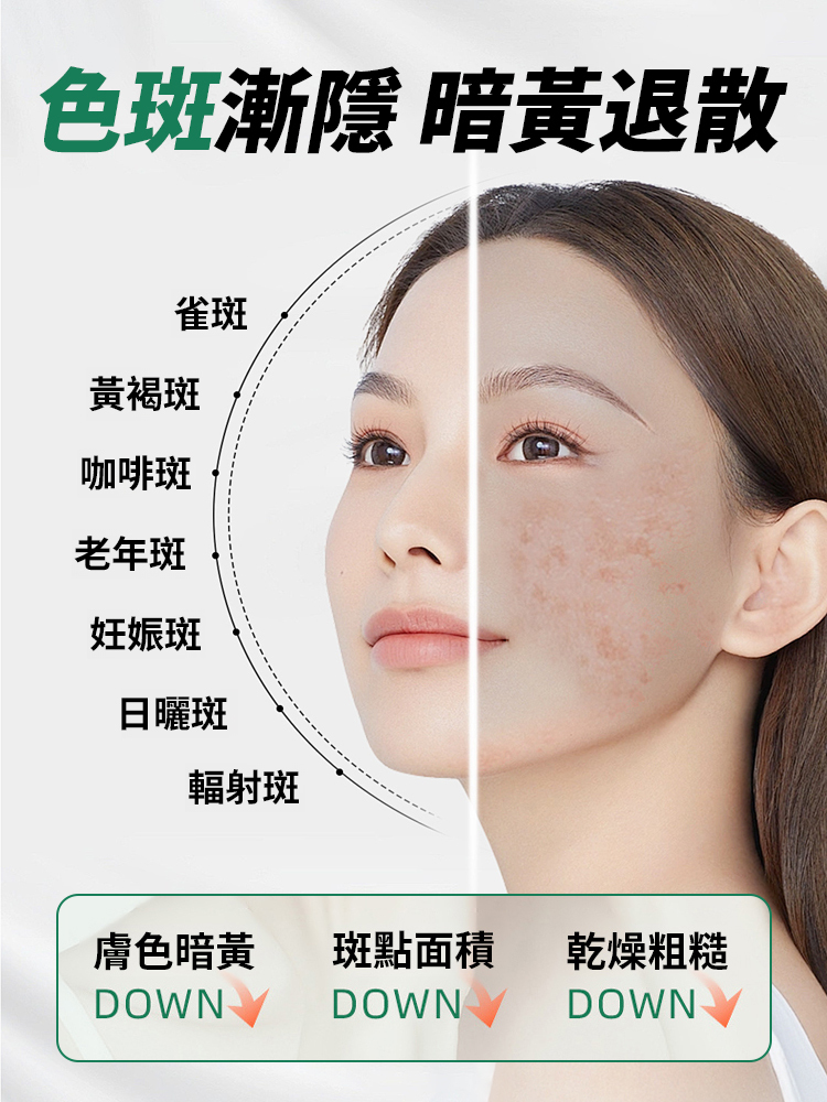 【全網銷量王】超強淡斑美白精華液