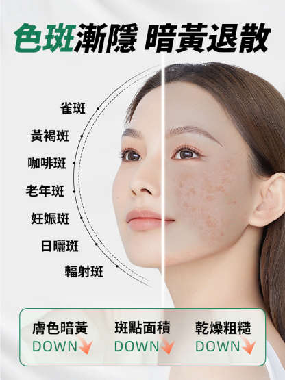 【全網銷量王】超強淡斑美白精華液