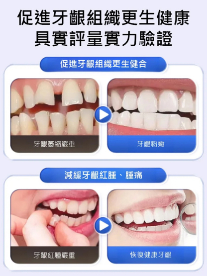 琺瑯質再生固齒美白牙科分離劑