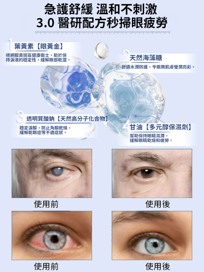 【嚴重模糊專用】葉黃素護眼護理噴霧