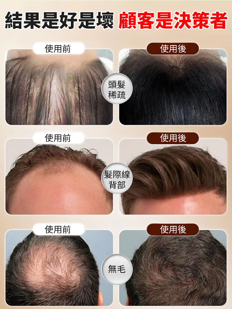 人參毛囊清潔洗髮精