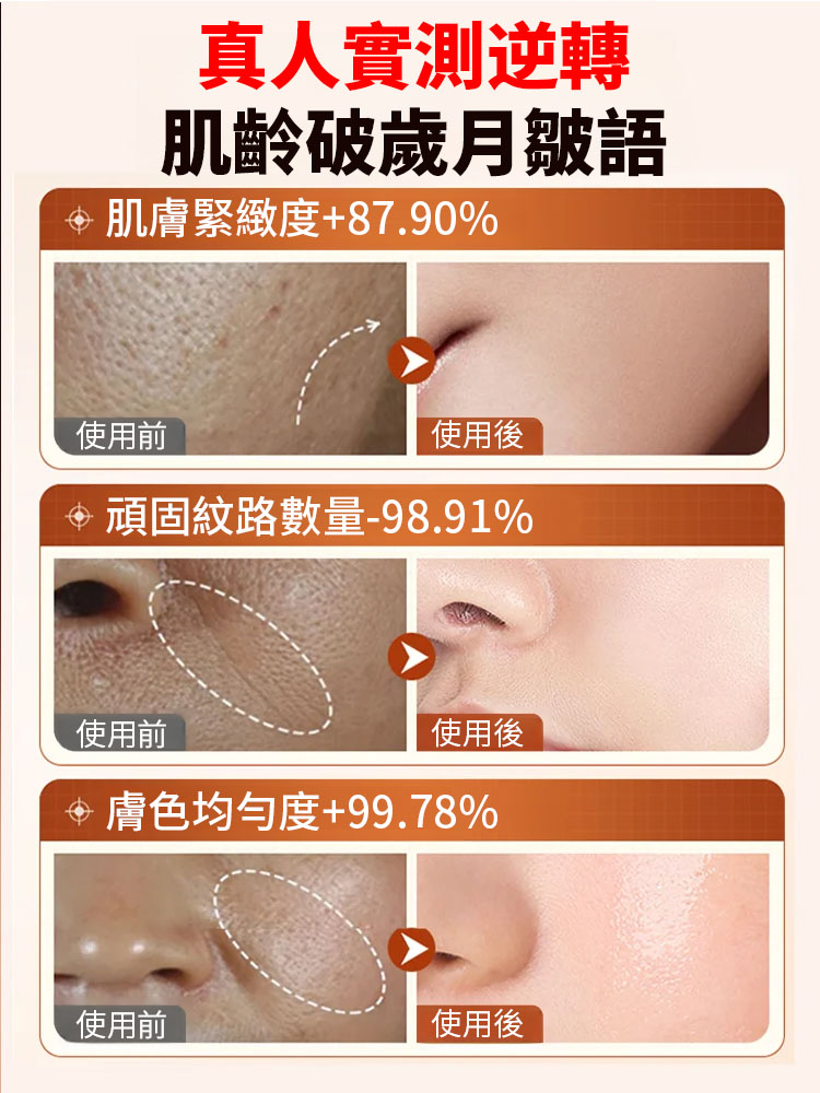 【秒去皺紋】依克多因逆齡精華