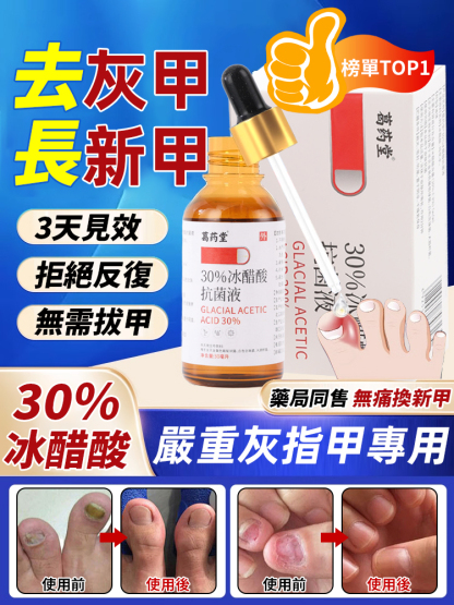 醫用30%冰醋酸3天終結灰甲