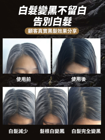 【白髮變黑】多種維生素B族片