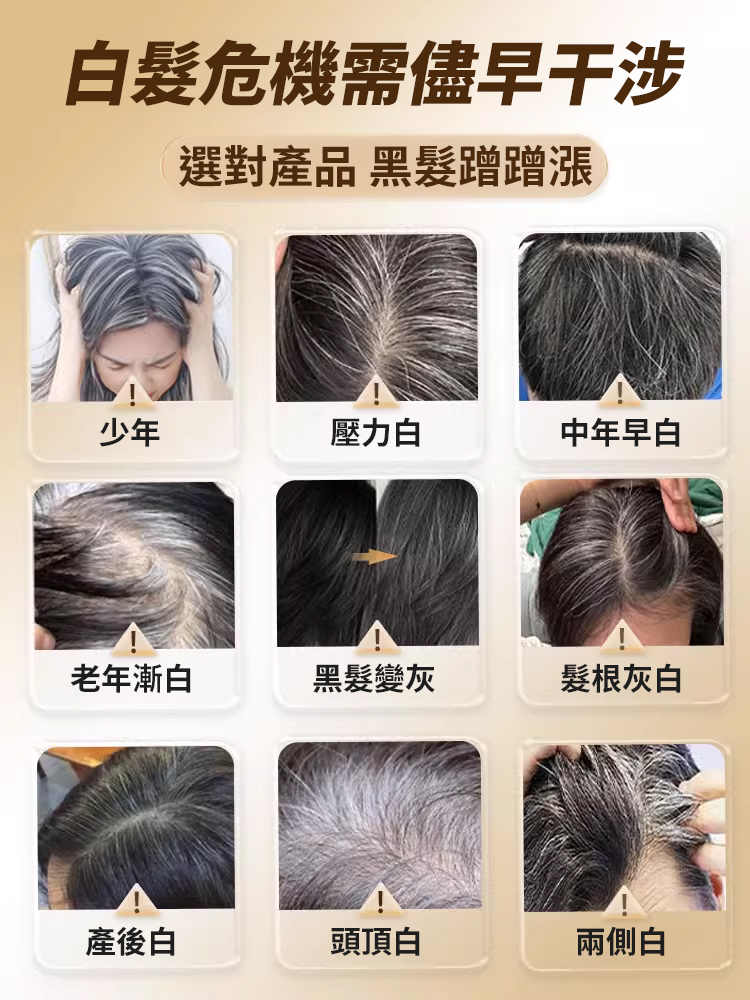【白髮變黑】多種維生素B族片
