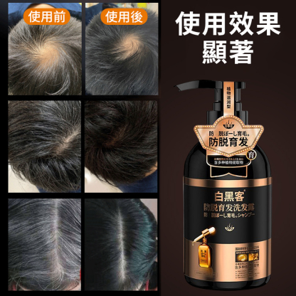 何首烏防脫髮洗黑育髮洗髮乳（植物滋潤型）