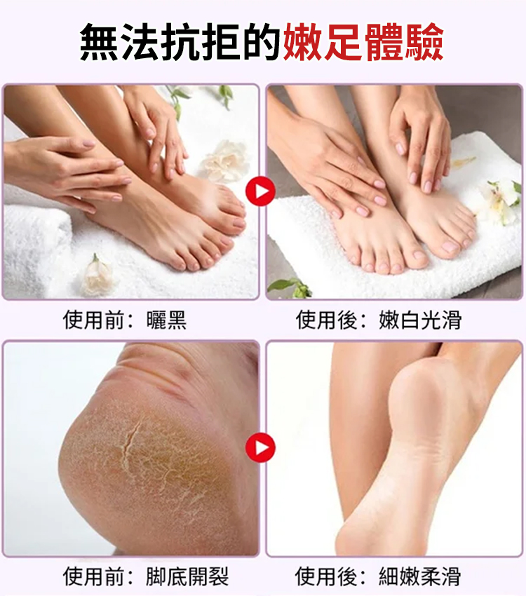 TLYA山羊奶煙酰胺足膜