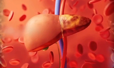 4.gif