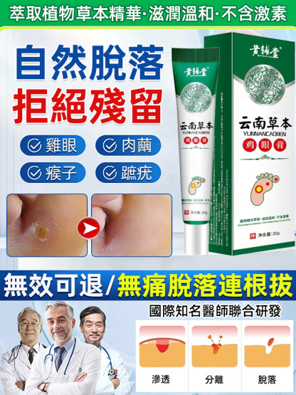 7天無痛去除草本雞繭膏