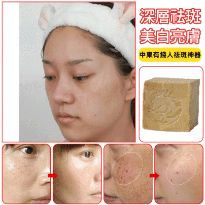 【敘利亞進口】三年月桂油古皂
