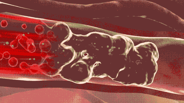 1_16.gif
