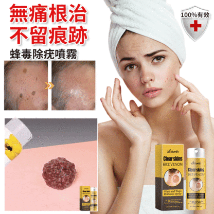 蜂毒克疣護理噴霧