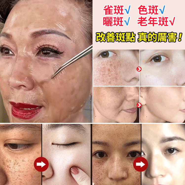 提亮膚色美白淡斑面膜