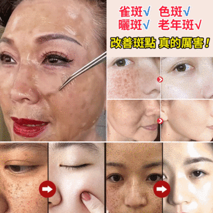 提亮膚色美白淡斑面膜