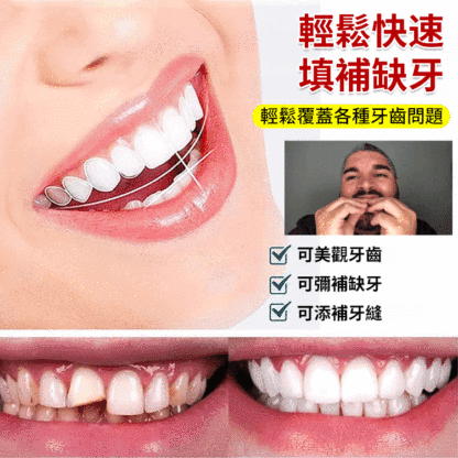 SorriBem完美微笑假牙