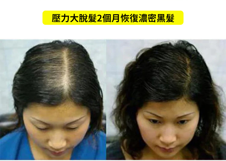 翻译件-SL-何首乌植物养发防脱-1202755-系统_31.jpg