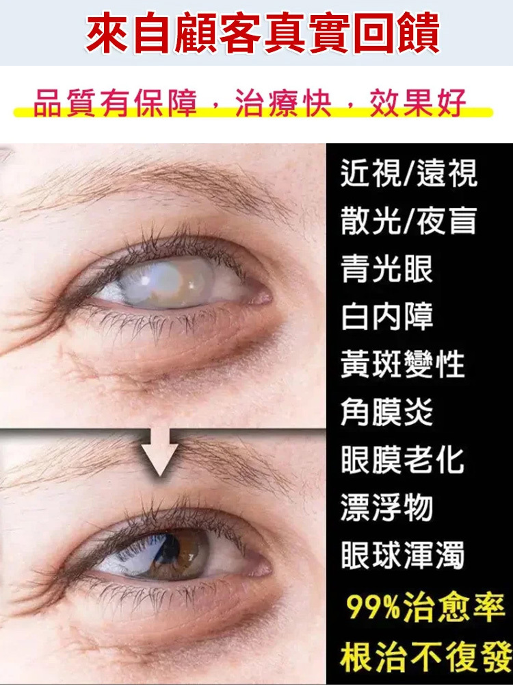 藍莓葉黃素護理液