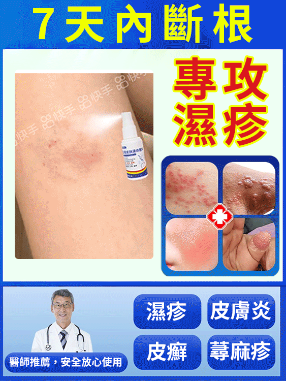 7天斷癢不反覆抑菌濕毒噴劑