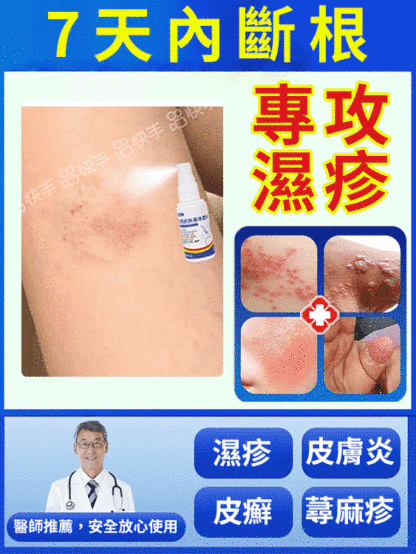 7天斷癢不反覆抑菌濕毒噴劑