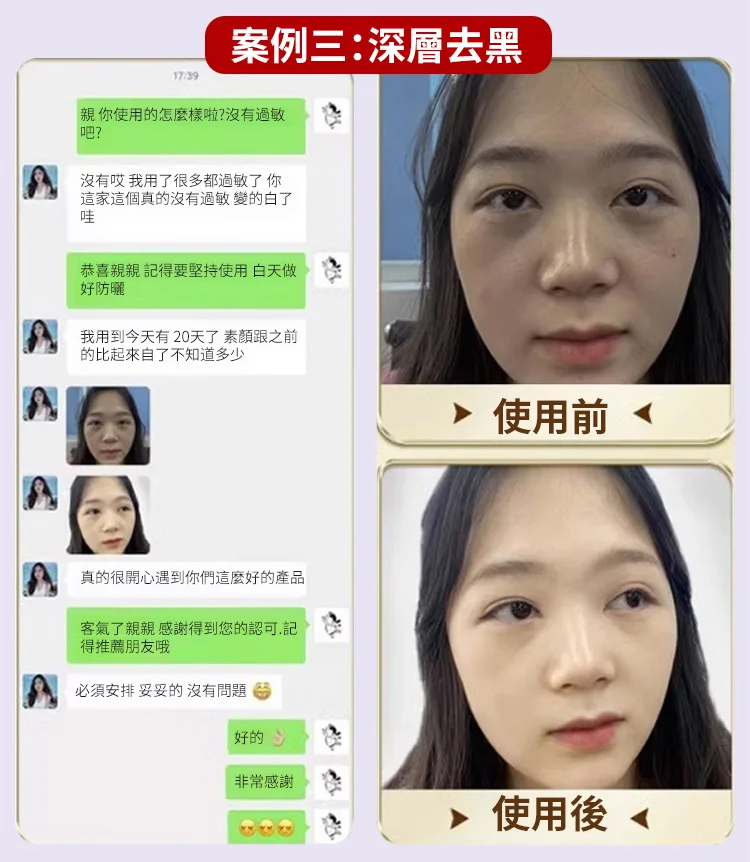 翻译件-JS-【3天变白，七天祛斑】草本美白祛斑霜-1228602-系统_17.jpg