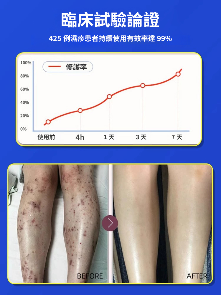 7天斷癢不反覆抑菌濕毒噴劑