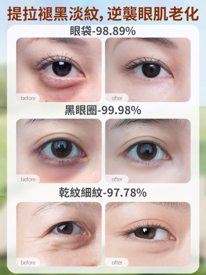 【1週見效】OTOU蝸牛精華眼貼