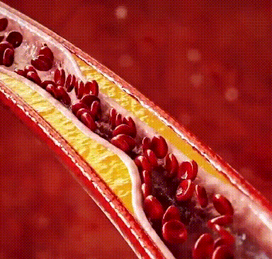 11f5e886ad0f1c2c10c130b392c78a91.gif