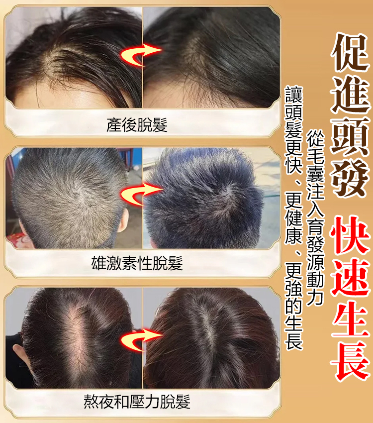 紅瑤淘米水防脫育發洗發水