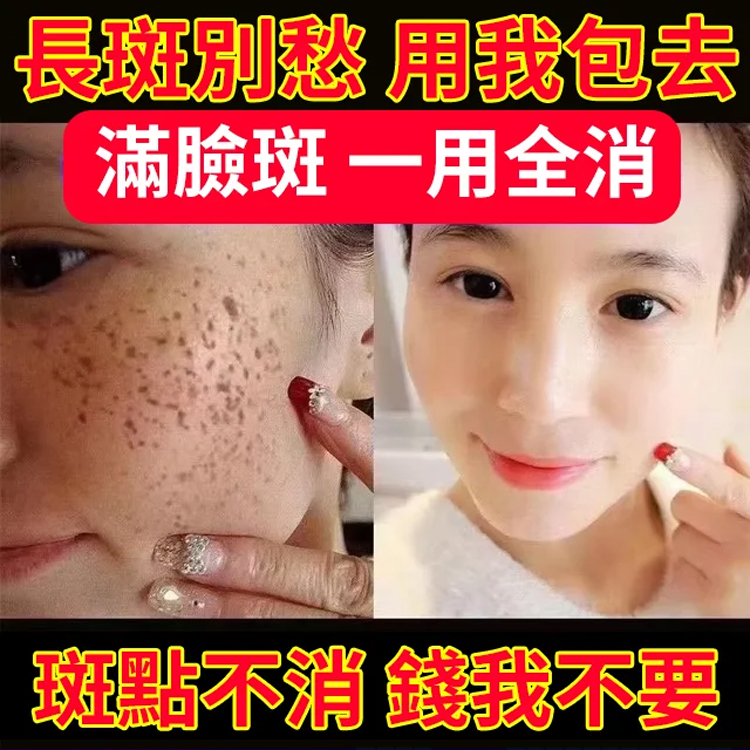 【3天變白，七天祛斑】草本美白祛斑霜