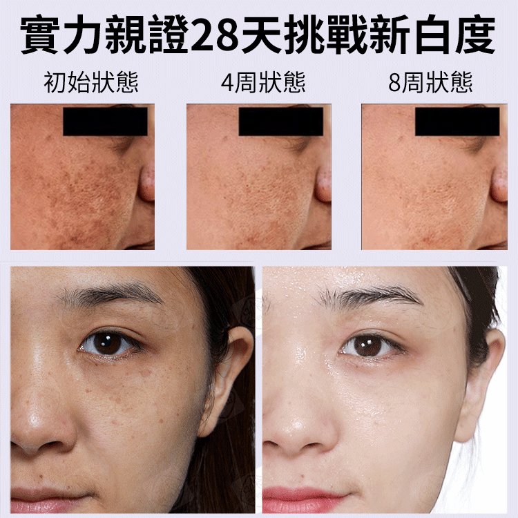 【3天變白，七天祛斑】草本美白祛斑霜