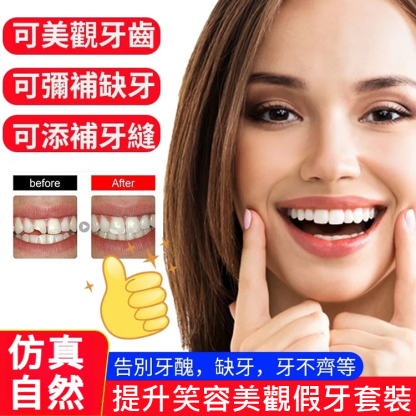 提升笑容美觀假牙套裝
