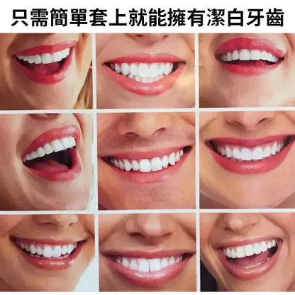 提升笑容美觀假牙套裝