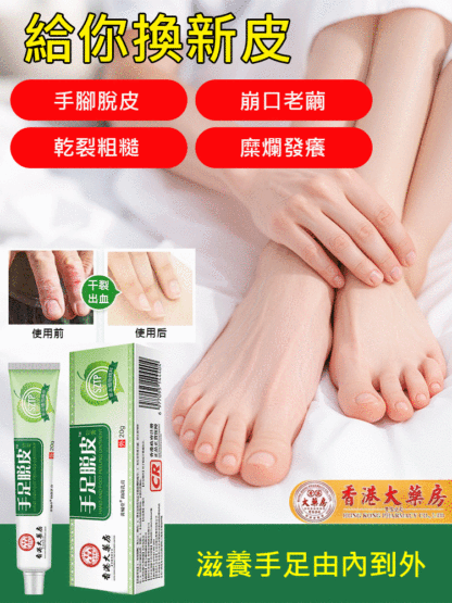 香港大藥房手足脫皮護膚膏