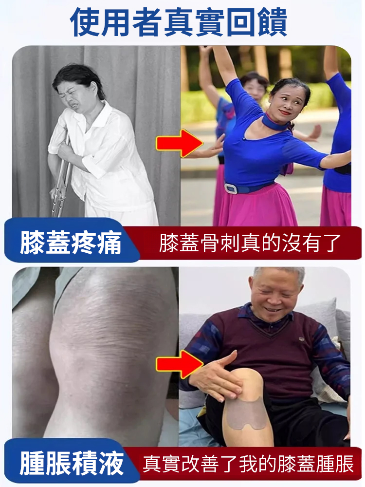 【專攻膝關節】全新升級膝蓋治療貼