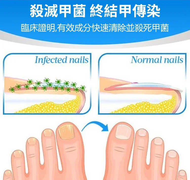 EFERO修复指甲膏