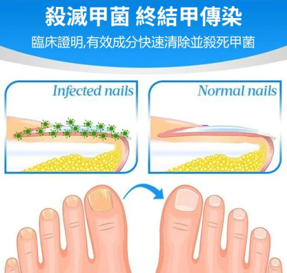 EFERO修复指甲膏
