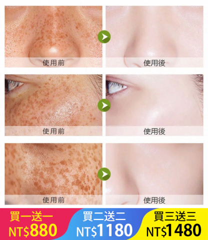 美白祛斑去黑頭補水潔面乳