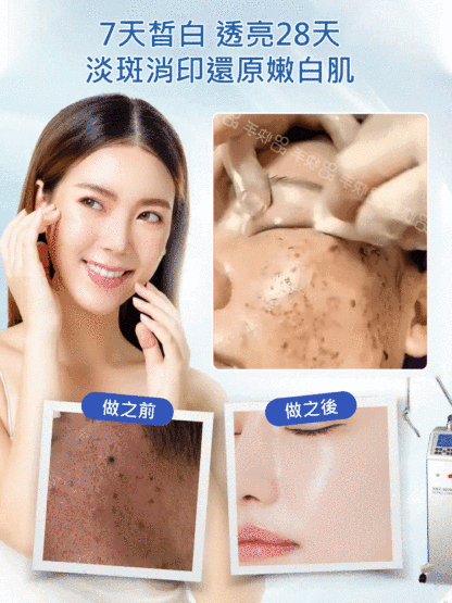 【老斑黃斑一抹消】淡斑尿素霜