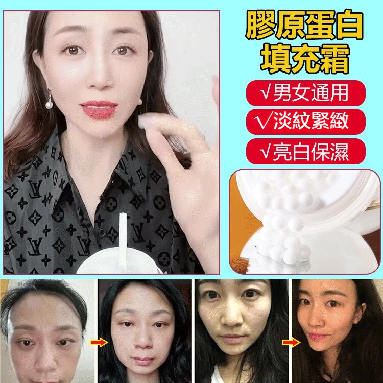 膠原蛋白填充霜