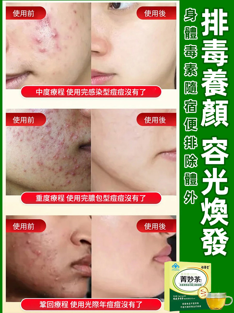 改善腸道功能李時珍菁妙茶