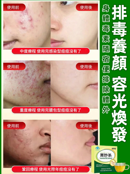 改善腸道功能李時珍菁妙茶